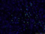 GP73/GOLPH2 Antibody in Immunohistochemistry (PFA fixed) (IHC (PFA))