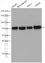 GP73/GOLPH2 Antibody in Western Blot (WB)