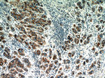 GP73/GOLPH2 Antibody in Immunohistochemistry (Paraffin) (IHC (P))