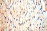GP73/GOLPH2 Antibody in Immunohistochemistry (Paraffin) (IHC (P))