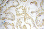 GP73/GOLPH2 Antibody in Immunohistochemistry (Paraffin) (IHC (P))