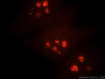 NHP2 Antibody in Immunocytochemistry (ICC/IF)