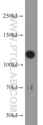 ABLIM1 Antibody in Western Blot (WB)
