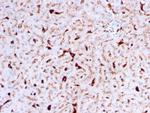 Cathepsin K Monoclonal Antibody (CTSK, 2792)