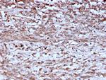 Cathepsin K Monoclonal Antibody (CTSK, 2793)