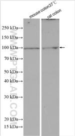 Villin Antibody in Western Blot (WB)
