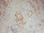 ATG4B Antibody in Immunohistochemistry (Paraffin) (IHC (P))