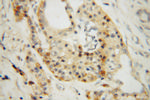 ATG4B Antibody in Immunohistochemistry (Paraffin) (IHC (P))