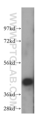 ATG4B Antibody in Western Blot (WB)