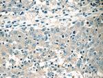HSCB Antibody in Immunohistochemistry (Paraffin) (IHC (P))