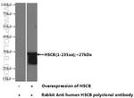 HSCB Antibody in Western Blot (WB)