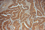 ADI1 Antibody in Immunohistochemistry (Paraffin) (IHC (P))