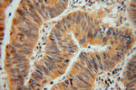 ADI1 Antibody in Immunohistochemistry (Paraffin) (IHC (P))