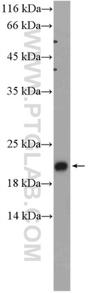ADI1 Antibody in Western Blot (WB)