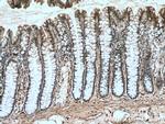 HRP 2 Antibody in Immunohistochemistry (Paraffin) (IHC (P))