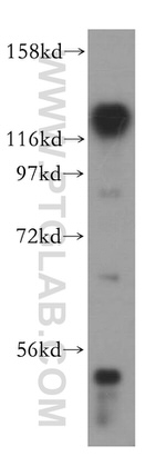 HRP 2 Antibody in Western Blot (WB)