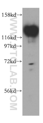 HRP 2 Antibody in Western Blot (WB)