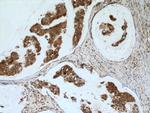 NME3 Antibody in Immunohistochemistry (Paraffin) (IHC (P))