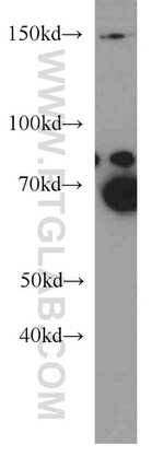 RPAP1 Antibody in Western Blot (WB)