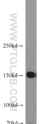 RPAP1 Antibody in Western Blot (WB)