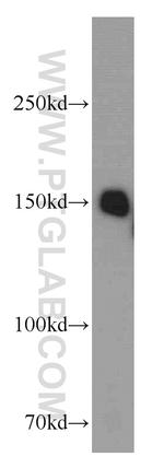 RPAP1 Antibody in Western Blot (WB)