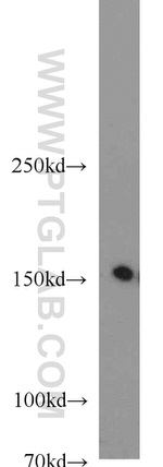 RPAP1 Antibody in Western Blot (WB)