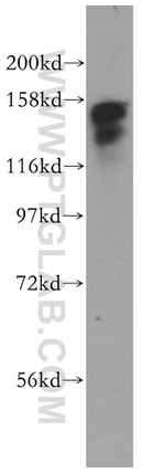 RPAP1 Antibody in Western Blot (WB)