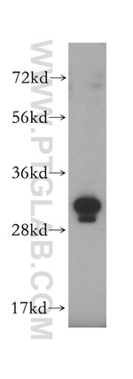 GTF2F2 Antibody in Western Blot (WB)