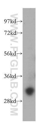 GTF2F2 Antibody in Western Blot (WB)
