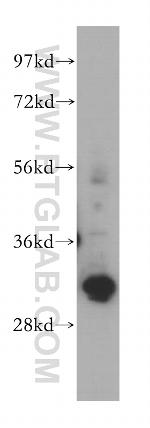 GTF2F2 Antibody in Western Blot (WB)