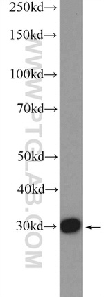 GTF2F2 Antibody in Western Blot (WB)