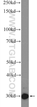 GTF2F2 Antibody in Western Blot (WB)