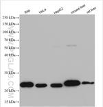 GLO1 Antibody in Western Blot (WB)