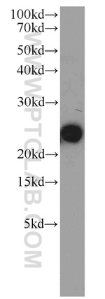 GLO1 Antibody in Western Blot (WB)