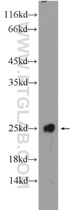 GLO1 Antibody in Western Blot (WB)