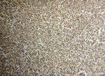 INPP5B Antibody in Immunohistochemistry (Paraffin) (IHC (P))