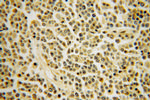 INPP5B Antibody in Immunohistochemistry (Paraffin) (IHC (P))