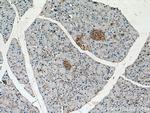 INPP5B Antibody in Immunohistochemistry (Paraffin) (IHC (P))