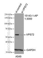 VPS72 Antibody in Western Blot (WB)