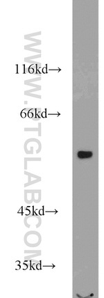 VPS72 Antibody in Western Blot (WB)