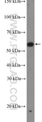 VPS72 Antibody in Western Blot (WB)
