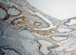 PPIL1 Antibody in Immunohistochemistry (Paraffin) (IHC (P))