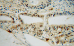 PPIL1 Antibody in Immunohistochemistry (Paraffin) (IHC (P))