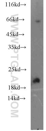 KCNE1 Antibody in Western Blot (WB)