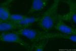 Prokineticin 1 Antibody in Immunocytochemistry (ICC/IF)