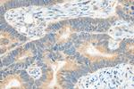 Prokineticin 1 Antibody in Immunohistochemistry (Paraffin) (IHC (P))