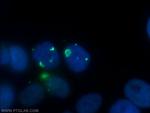 PSMB2 Antibody in Immunocytochemistry (ICC/IF)