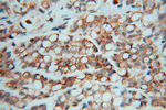 PSMB2 Antibody in Immunohistochemistry (Paraffin) (IHC (P))