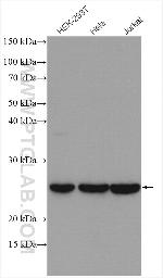 PSMB2 Antibody in Western Blot (WB)