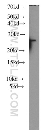 PSMB2 Antibody in Western Blot (WB)